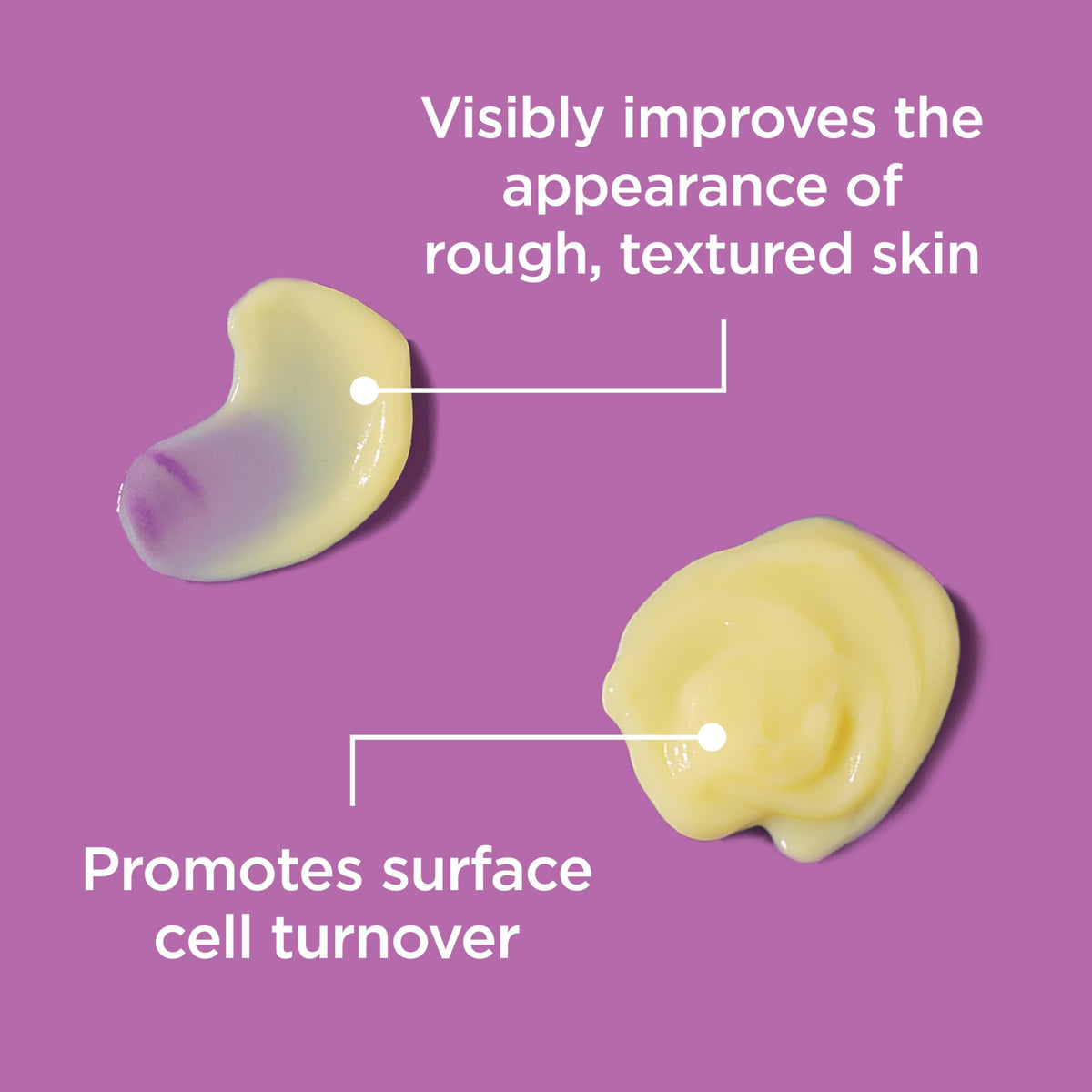 Differin gel on fingertip ready to apply for targeted treatment