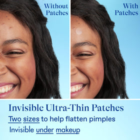Differin lifestyle bathroom routine showing easy nightly use