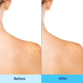 Differin fine mist texture close-up demonstrating even coverage