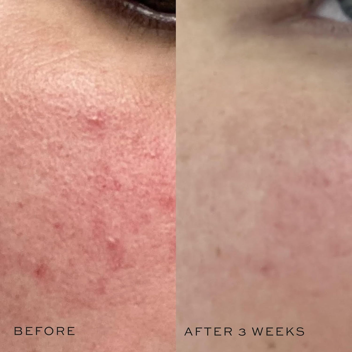 DIME pouring toner into hand illustrating easy application and hydration