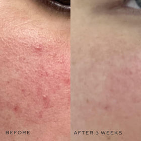 DIME pouring toner into hand illustrating easy application and hydration