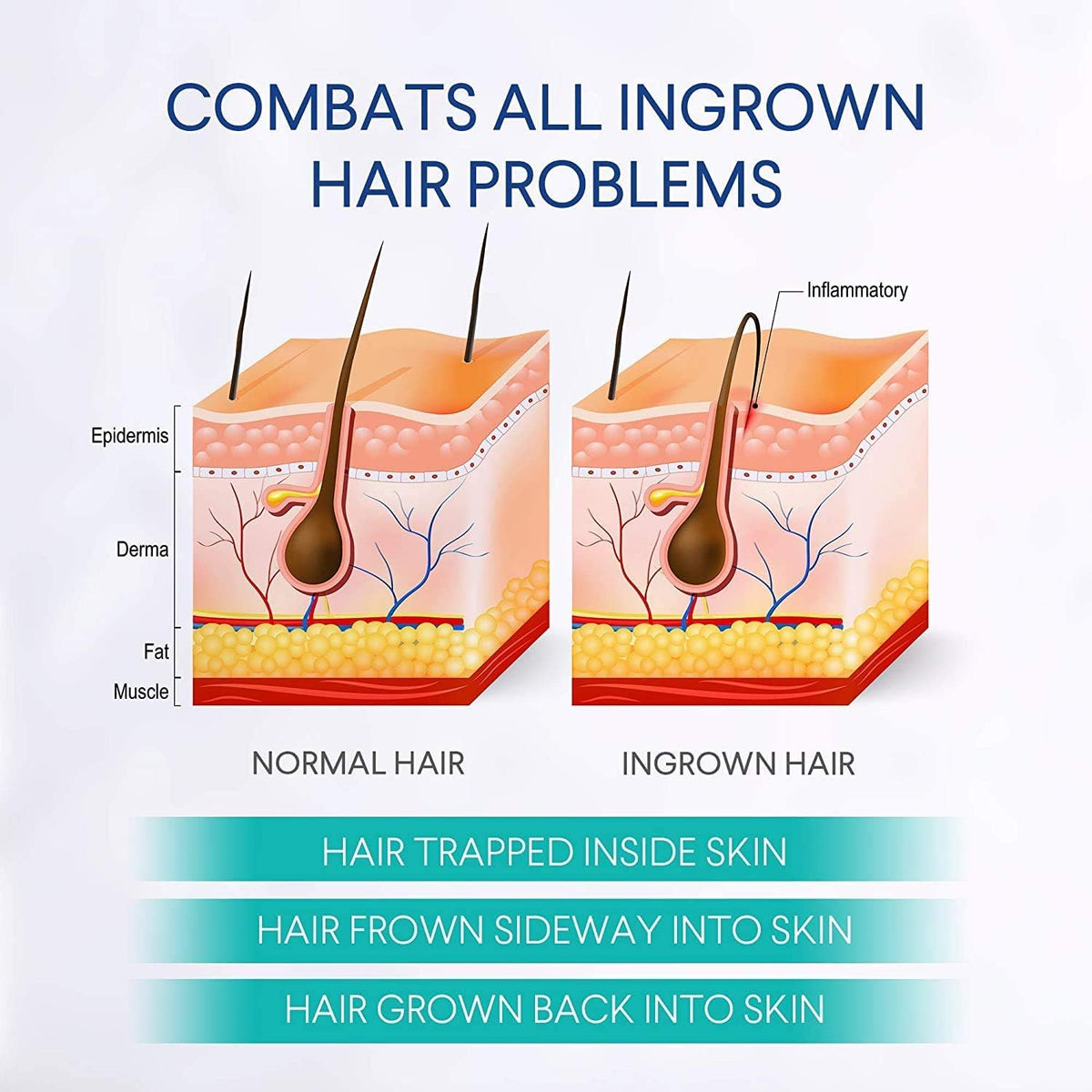 Dinocook applied to bikini area to reduce bumps and irritation