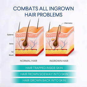 Dinocook applied to bikini area to reduce bumps and irritation