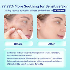 Ditoi towel used wet on face to remove makeup quickly and gently
