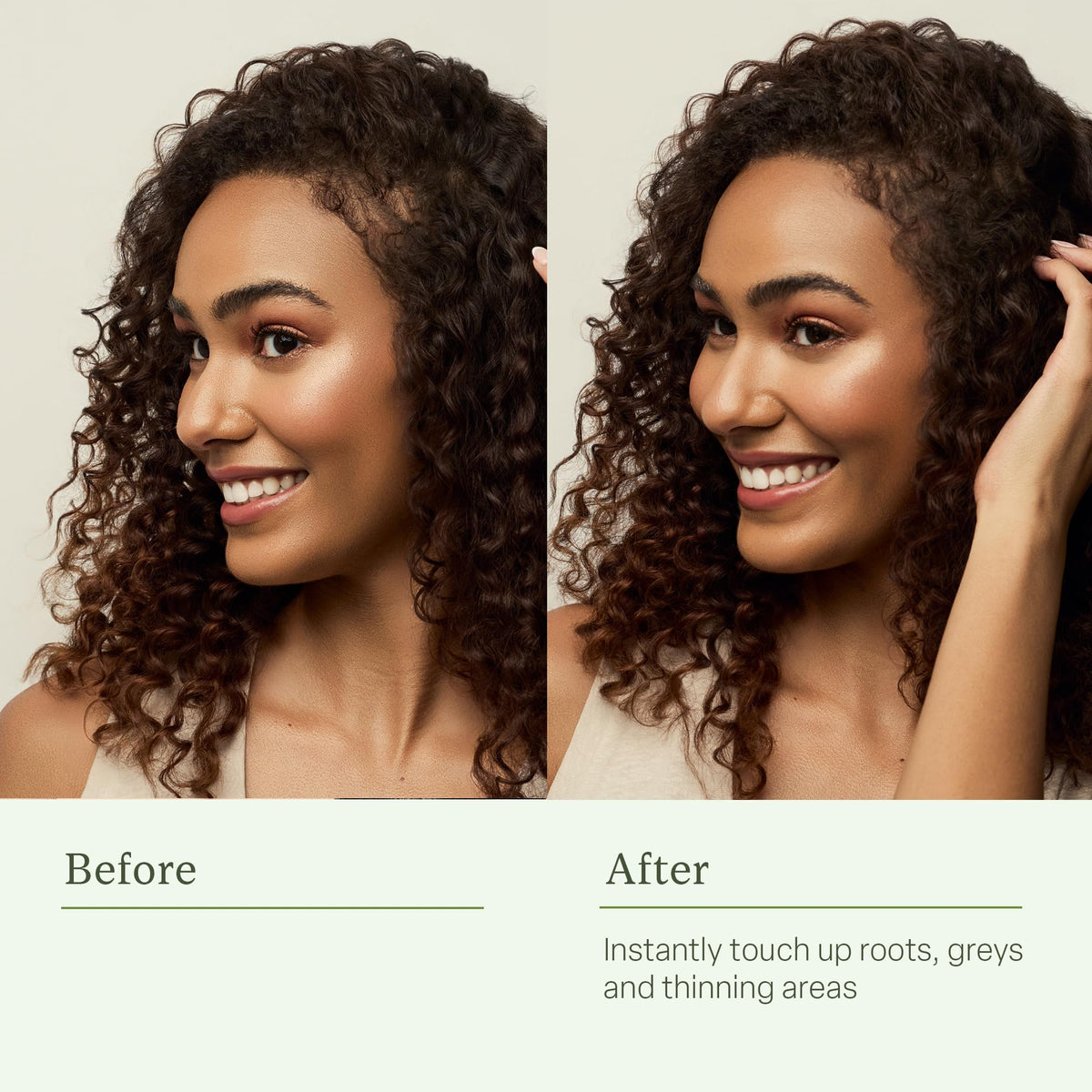 divi before and after hairline demonstrating reduced visibility