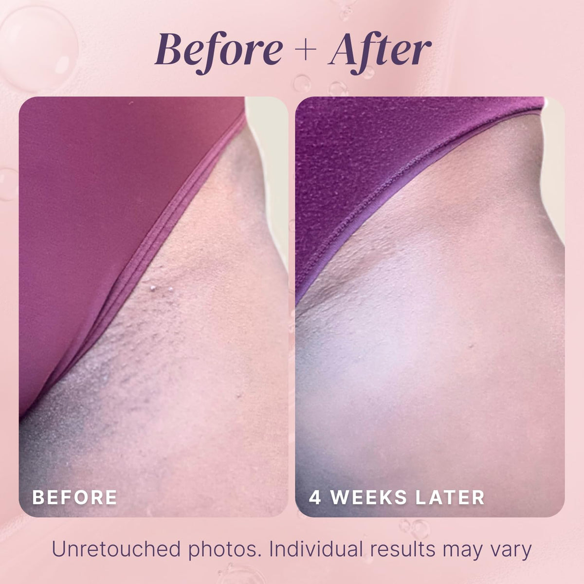 Divine Derriere ingredient highlight salicylic acid for gentle exfoliation
