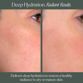 Doctor Rogers before and after results illustrating smoother, more luminous skin benefit