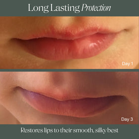 Doctor Rogers lip balm back label close-up listing gentle, clean ingredients
