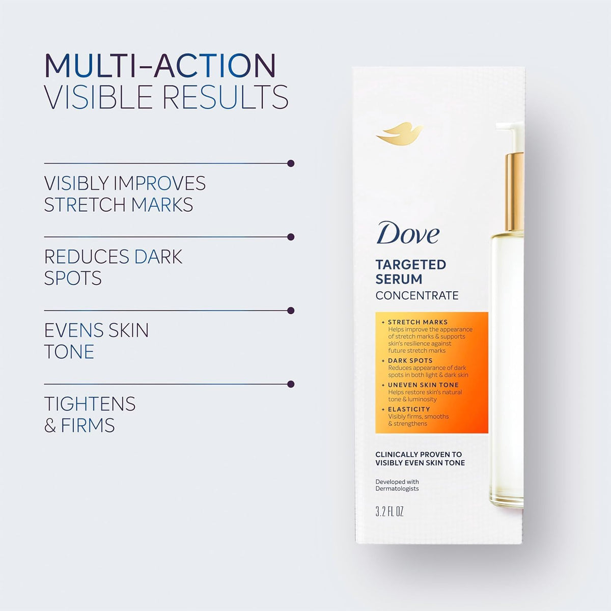 Applying Dove serum to stretch marks shows targeted treatment benefit
