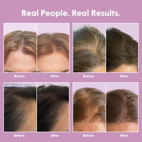 dpHUE applying tinted powder to dark brown roots to absorb oil and disguise regrowth