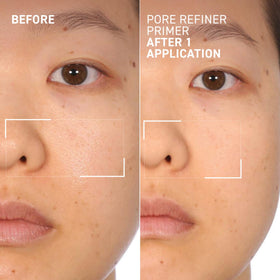 Dr. Brandt before and after T-zone image showing visible pore reduction