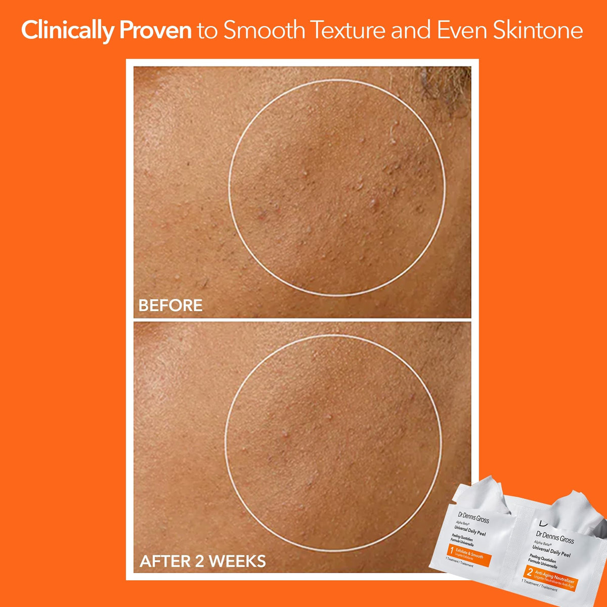 Dr. Dennis Gross Step 1 wipe in hand demonstrating easy application for refreshed skin