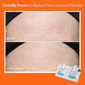 Dr. Dennis Gross open box showing organized pads and clean presentation