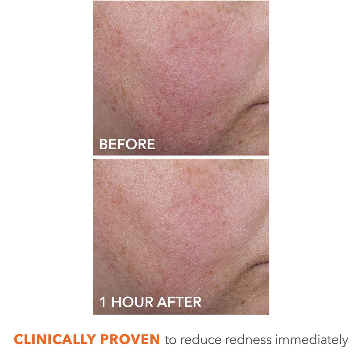 Dr Dennis Gross side label close-up showing ingredients and clinical-style formulation benefits