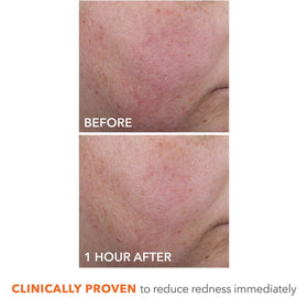 Dr Dennis Gross side label close-up showing ingredients and clinical-style formulation benefits