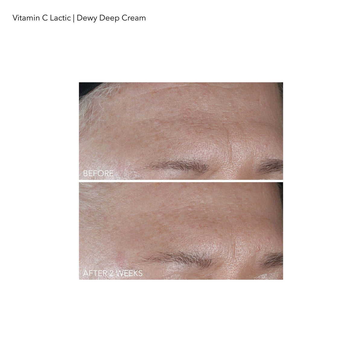 Dr Dennis Gross close-up visual of squalane and ceramides indicating moisturize and barrier support