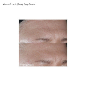Dr Dennis Gross close-up visual of squalane and ceramides indicating moisturize and barrier support