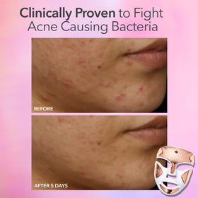 Dr Dennis Gross FaceWare Pro worn during bathroom skincare routine for time-saving use