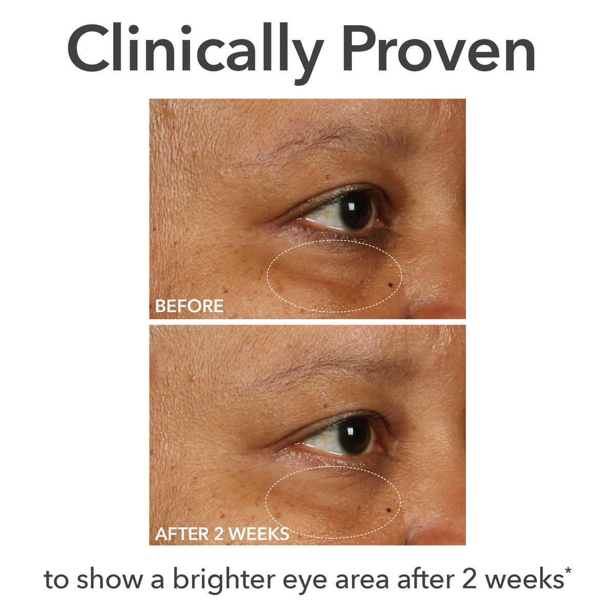 Dr Dennis Gross pump and applicator detail for precise eye application