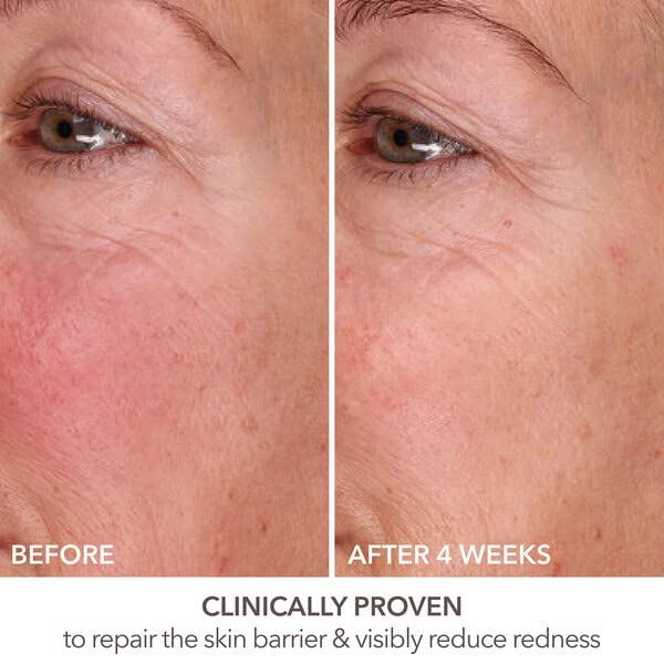 Dr Dennis Gross serum layered under makeup showing smooth base and visible blurring