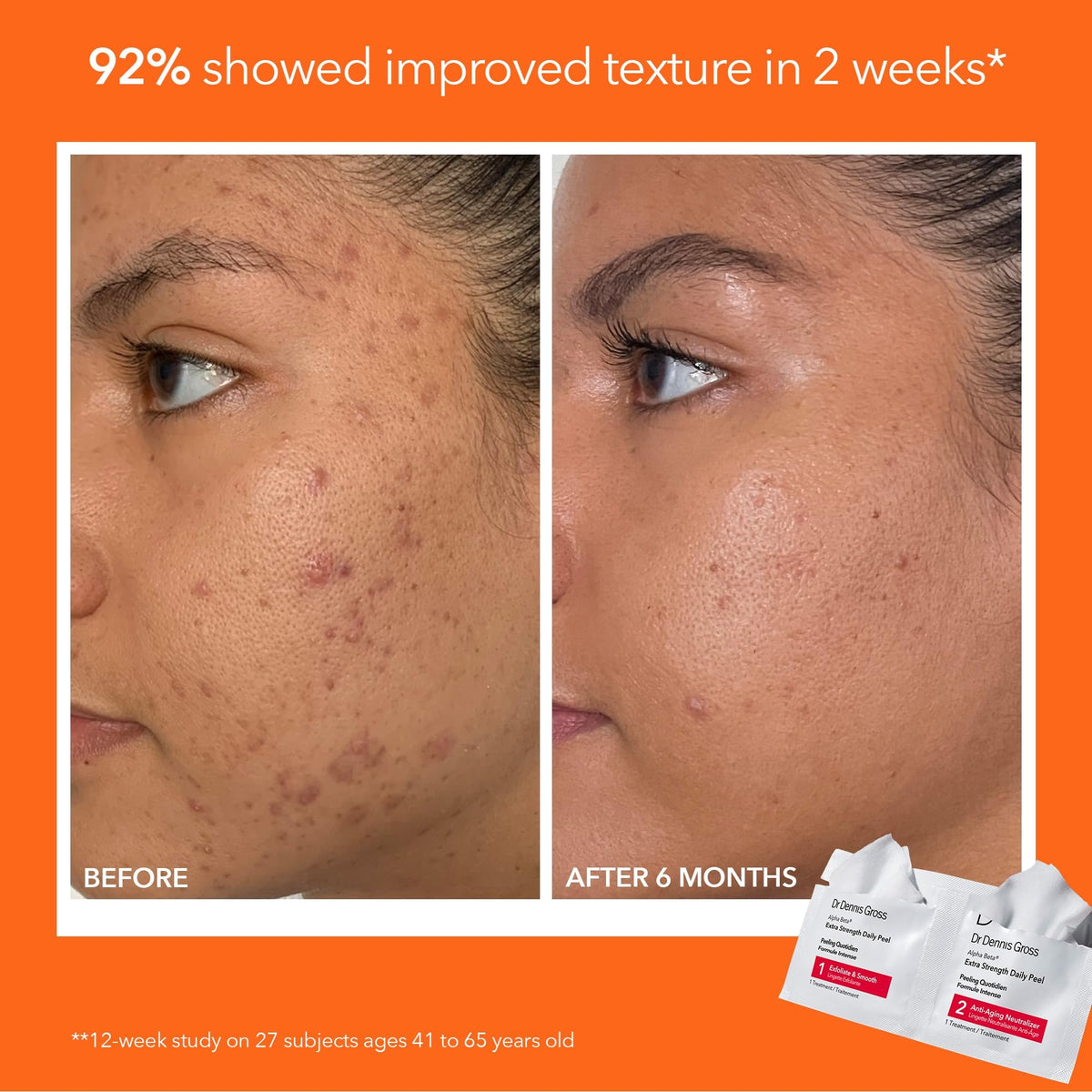 Dr Dennis Gross peel swatch on skin showing smooth texture and quick resurfacing