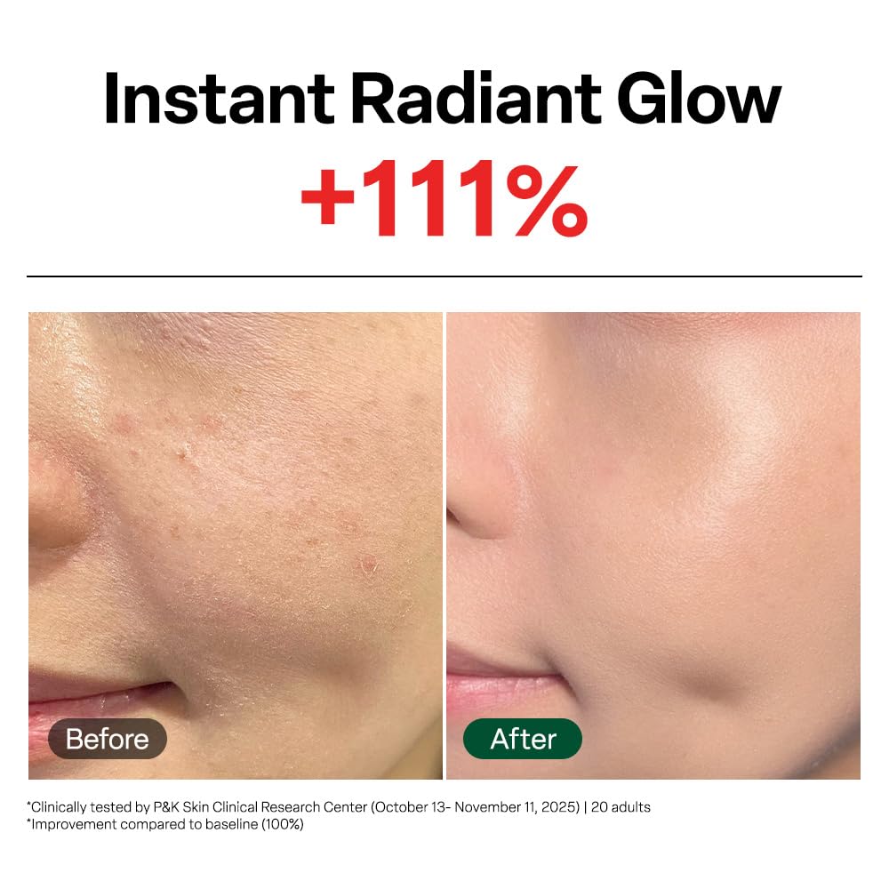 Dr. G before and after texture comparison showing improved smoothness