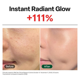 Dr. G before and after texture comparison showing improved smoothness