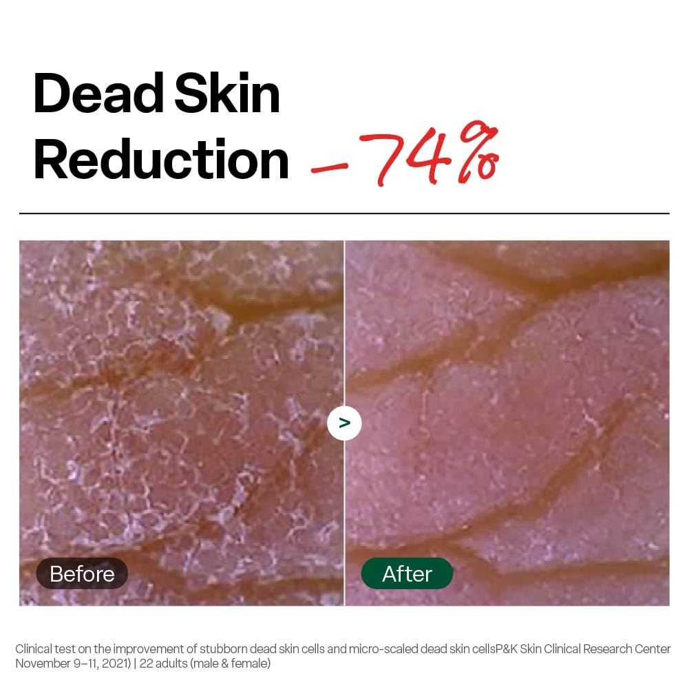 Dr. G gel forming small pellets to visibly remove dead cells