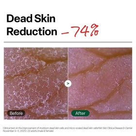Dr. G gel forming small pellets to visibly remove dead cells