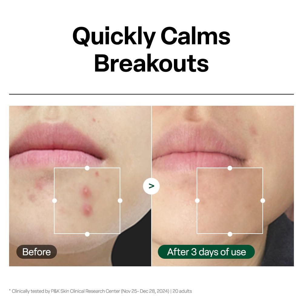 Dr.G serum being smoothed on hand to demonstrate fast-absorbing feel
