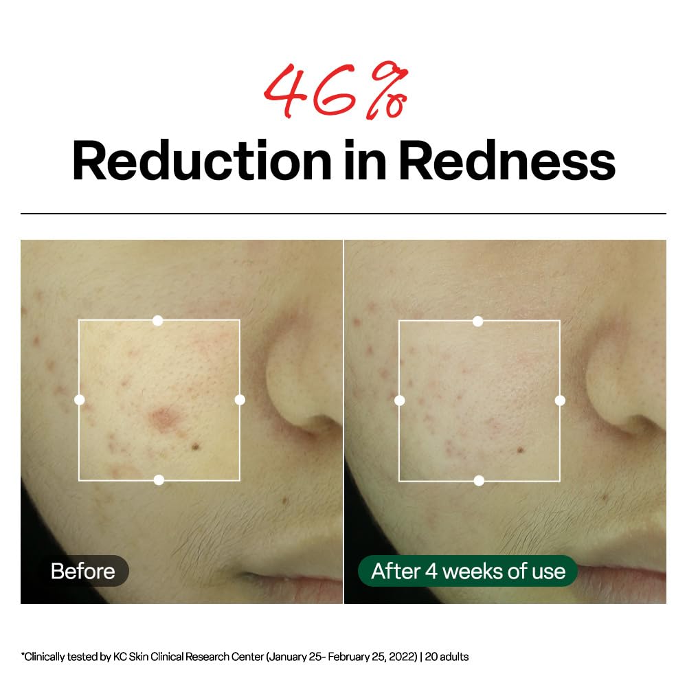 Dr.G swatch on forearm showing thin spreadability and hydration effect