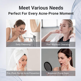 Dr.Leo staged before-and-after pores showing clearer, minimized appearance