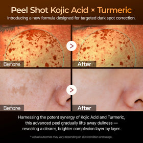 Dr.Melaxin serum in hand illustrating lightweight feel and quick sink-in