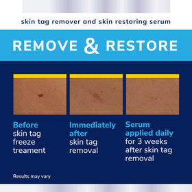 Dr. Scholl's kit contents laid out showing applicators, instructions, and serum
