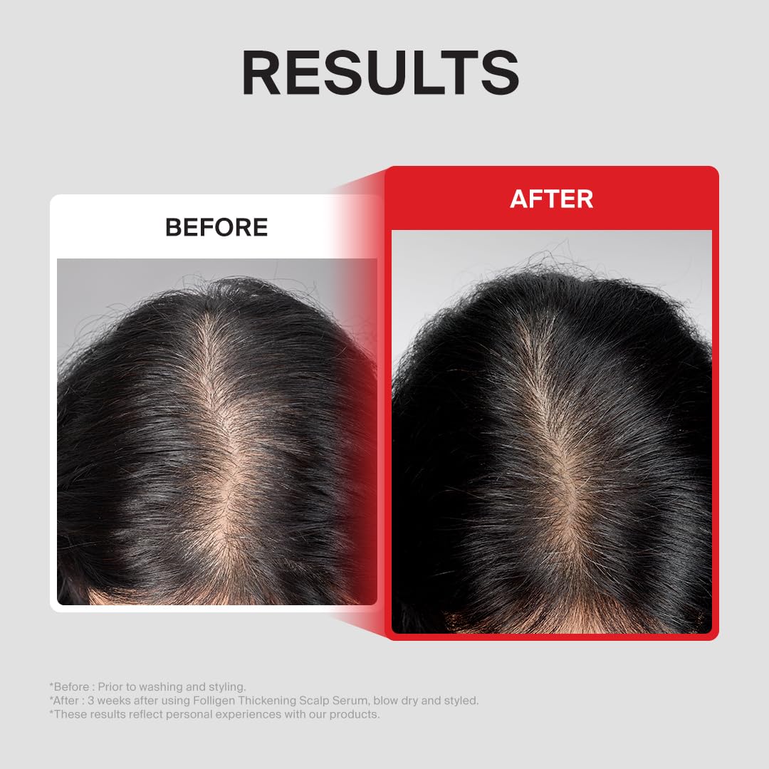 DR.FORHAIR applying serum to roots demonstrating simple daily scalp massage