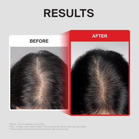 DR.FORHAIR applying serum to roots demonstrating simple daily scalp massage