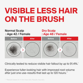 DR.FORHAIR foam texture on palm highlighting gentle lather and lightweight cleanse