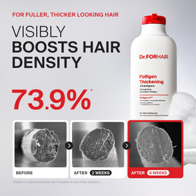 DR.FORHAIR label close-up highlighting biotin and salicylic acid