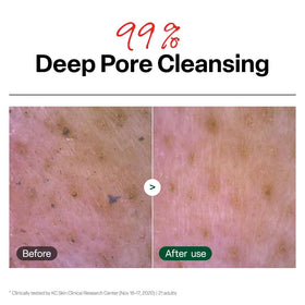 Dr.G gel foamed texture close-up showing rich, gentle foam hydration