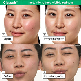 Dr.Jart+ Centella ingredient close-up highlighting soothing barrier support