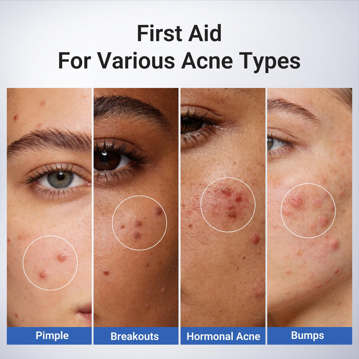 Dr.Leo before and after spot example illustrating reduced redness and faster calming