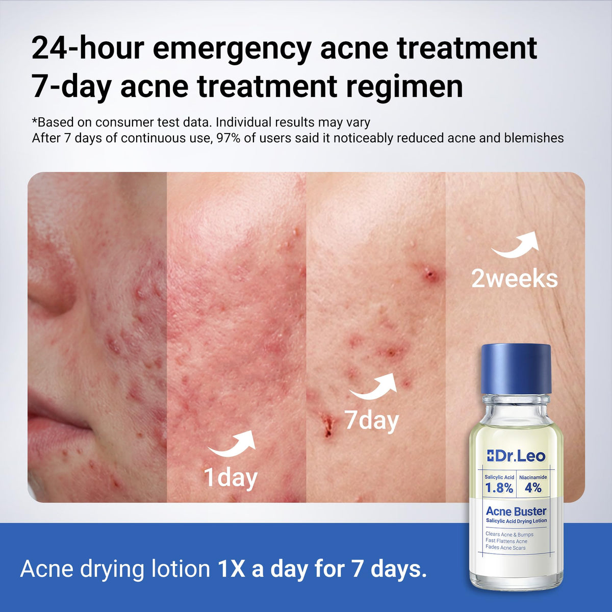 Dr.Leo bottle on nightstand conveying overnight spot treatment ease and readiness