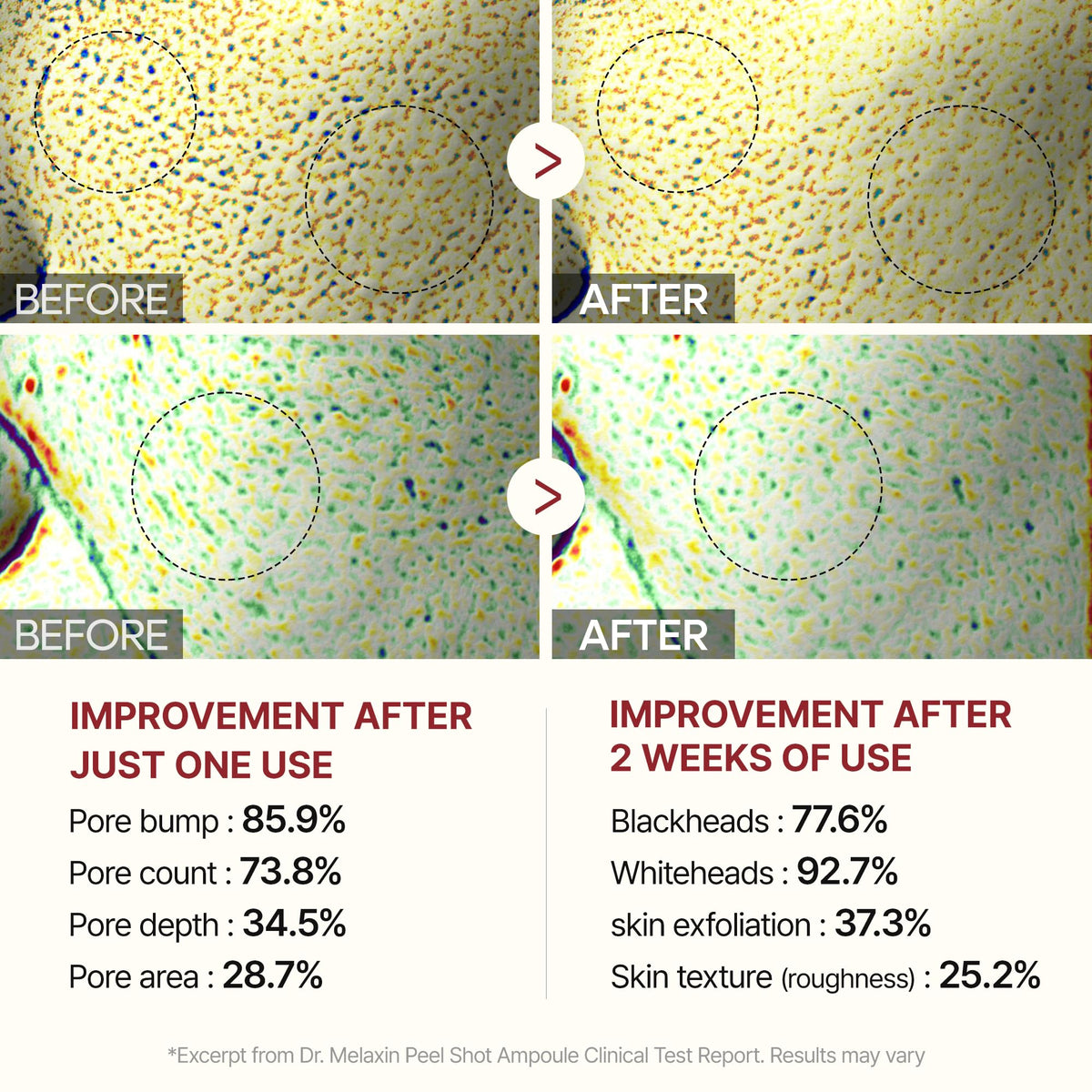 Dr.Melaxin applied to skin demonstrating smooth, non-greasy finish