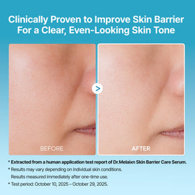Dr.Melaxin before and after skin texture comparison showing smoother pores