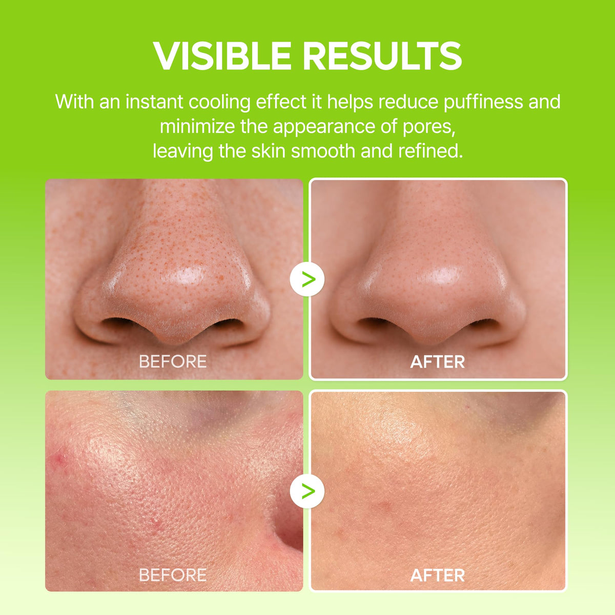 Dr.Melaxin under-eye use showing de-puffing effect for refreshed appearance
