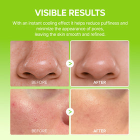 Dr.Melaxin under-eye use showing de-puffing effect for refreshed appearance