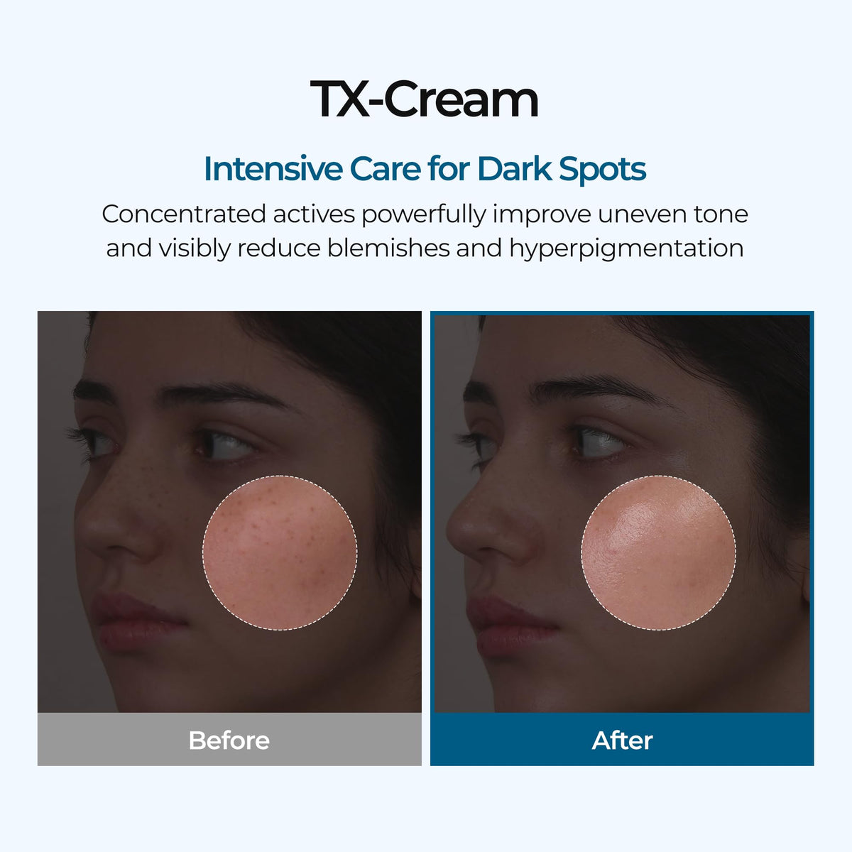 Dr.Melaxin cream open jar texture close-up highlighting smooth hydration