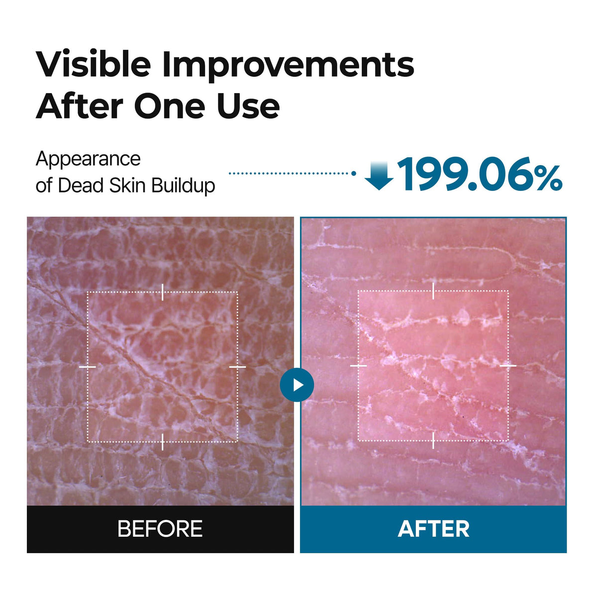 Dr.Melaxin close-up of mist on skin showing lightweight texture