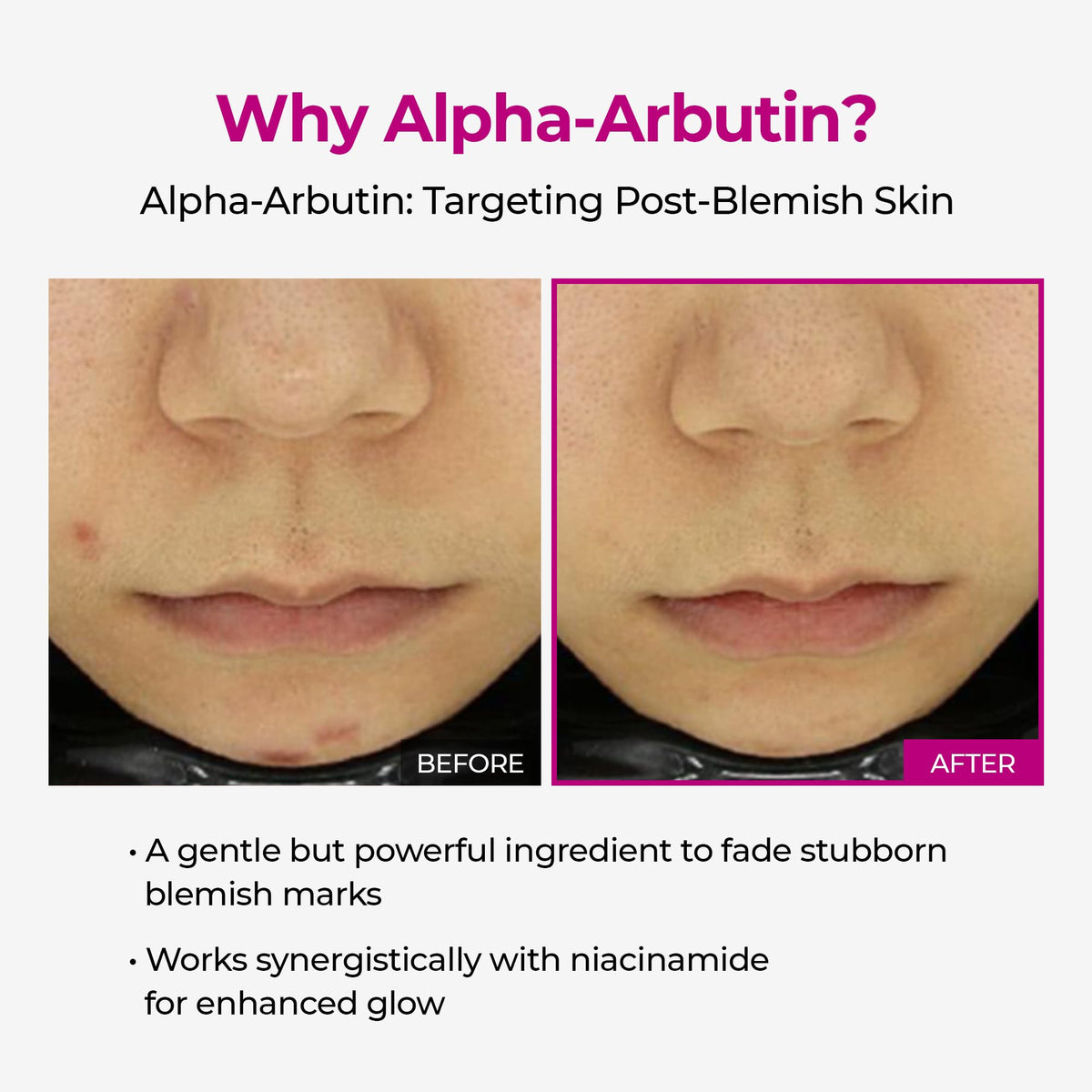 Dr.Melaxin label detail showing alpha‑arbutin and niacinamide ingredient benefits