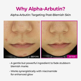 Dr.Melaxin label detail showing alpha‑arbutin and niacinamide ingredient benefits